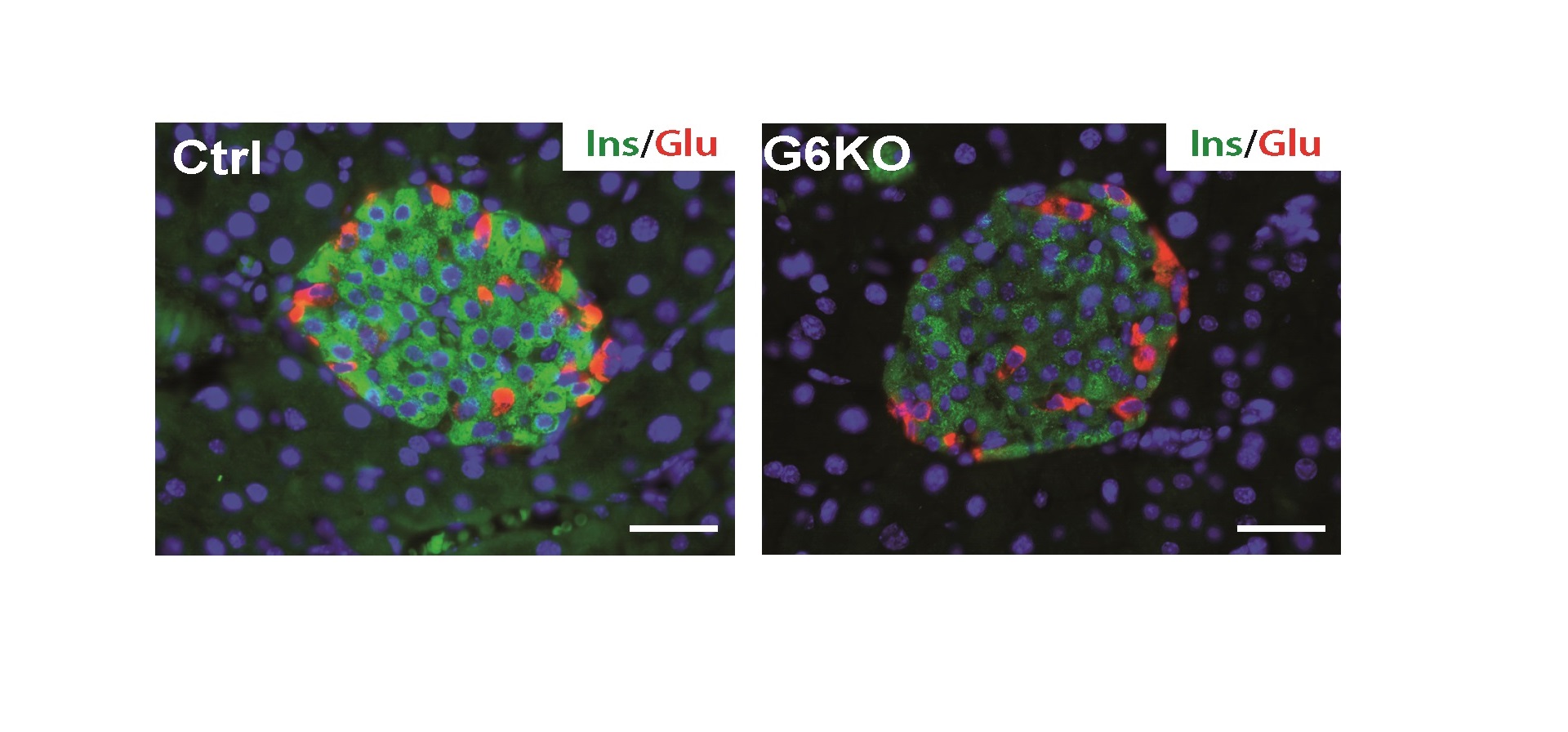 GATA6, un nuevo regulador de la fisiología de la célula beta