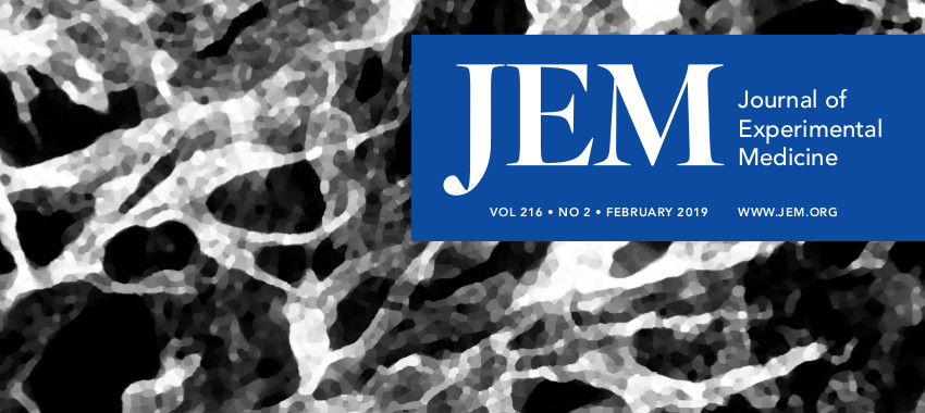 Descubren la mutación genética causante de la linfangiomatosis