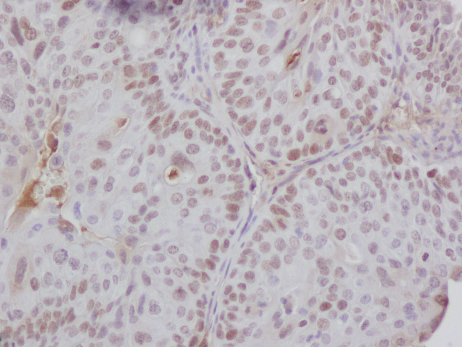 Un nuevo tratamiento remite el cáncer de vejiga en ratones