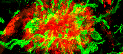 Descubierta una nueva diana terapéutica para el tratamiento de la enfermedad de Alzheimer