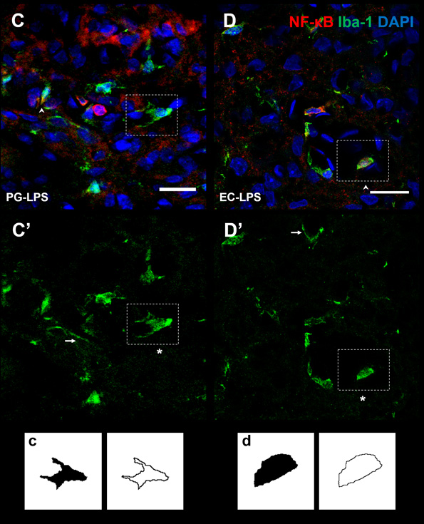 Demuestran que no todos los componentes bacterianos provenientes de la microbiota activan de igual forma la señal inflamatoria en el cerebro