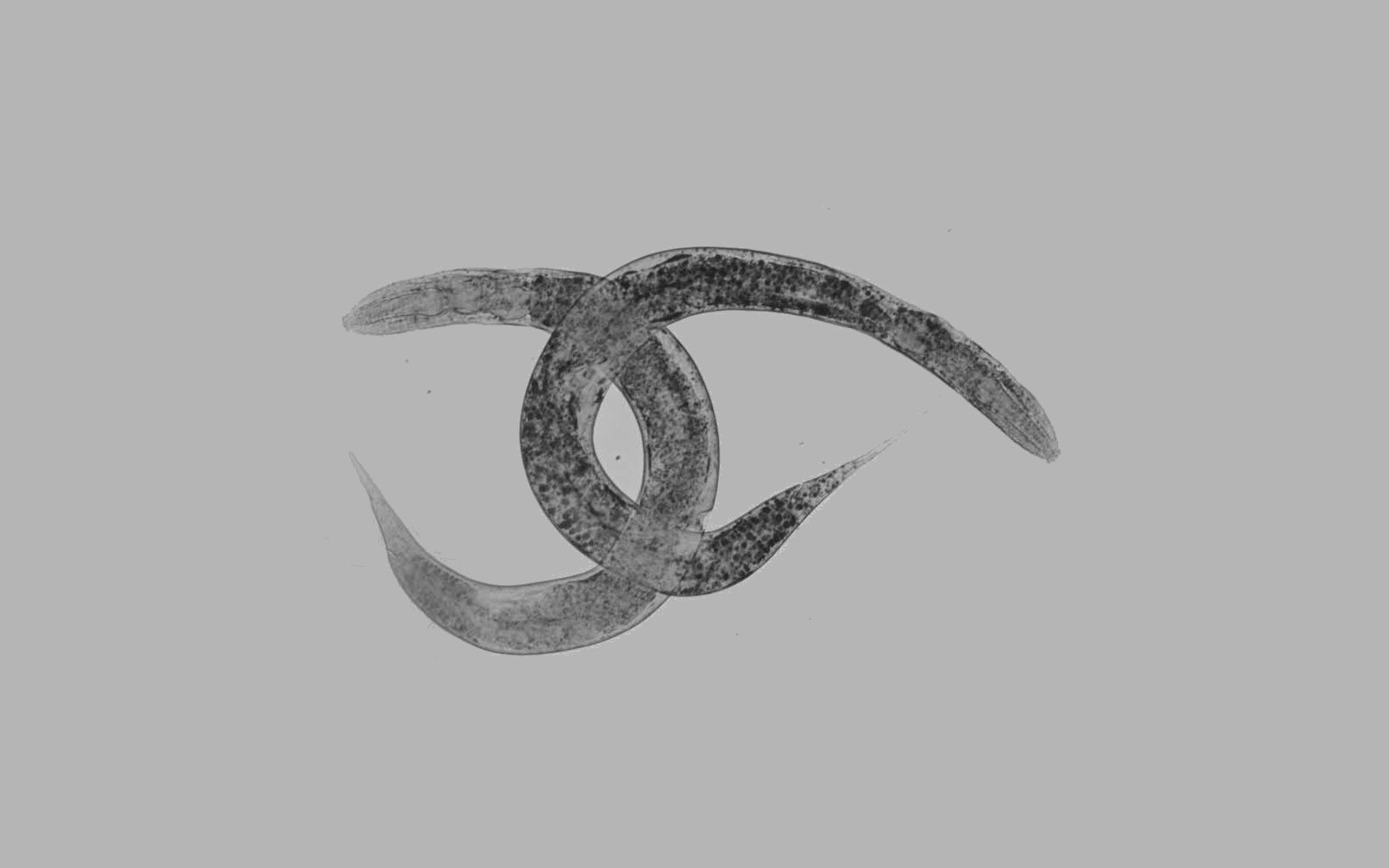 Un nuevo modelo de ‘C. Elegans’ permitirá avanzar en el estudio de la X-ALD