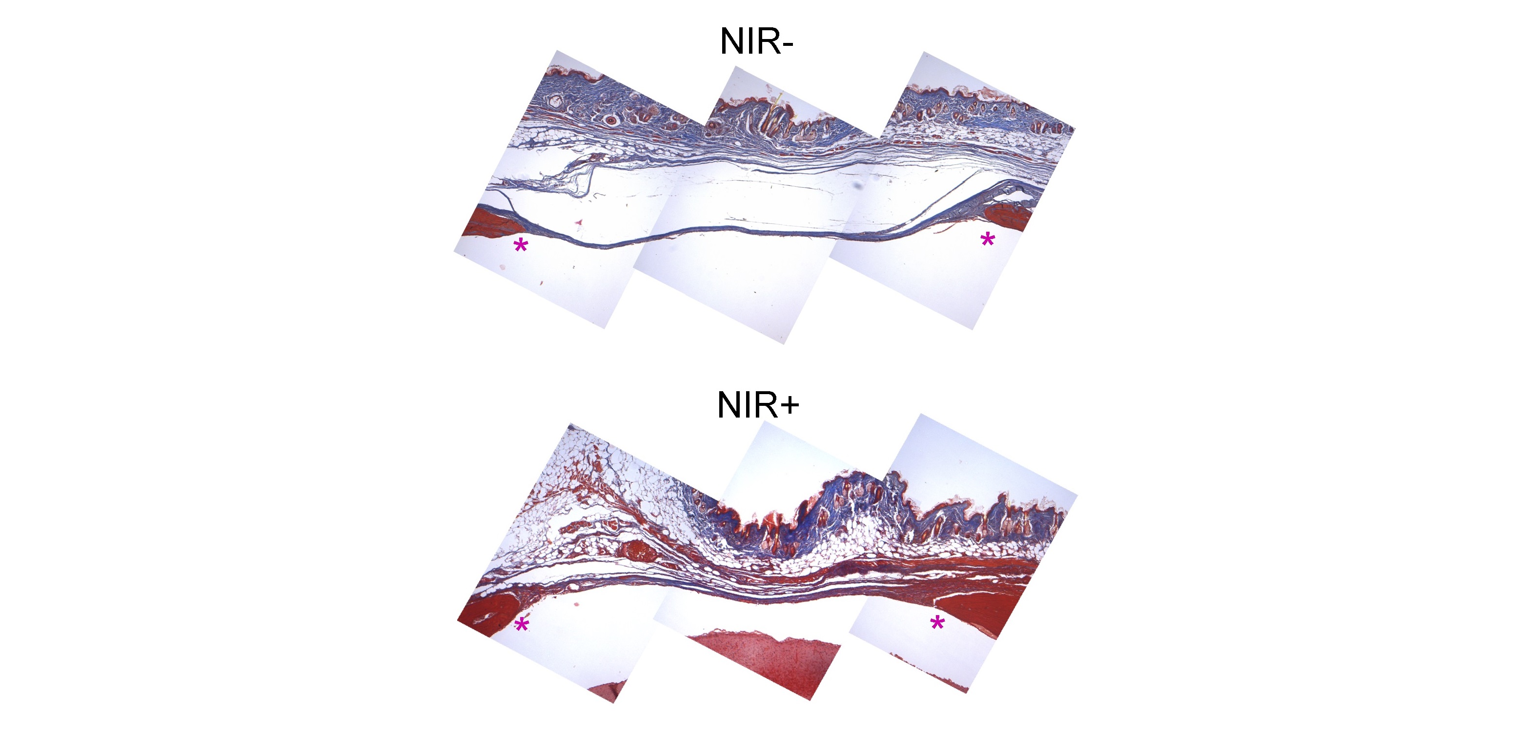 Desarrollan hidrogeles sensibles al infrarrojo para controlar la regeneración de tejido óseo