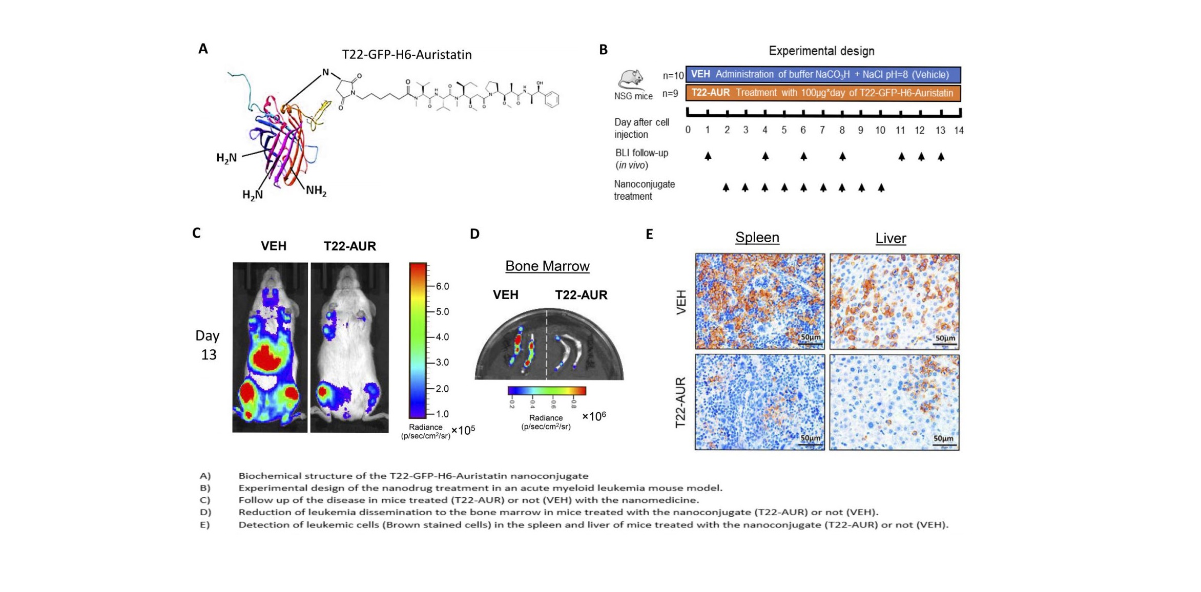 Logran un nanoconjugado dirigido a las células neoplásicas que bloquea la diseminación de la leucemia mieloide aguda