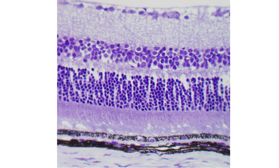 Revisan el papel de la vía de pigmentación de la retina en el albinismo humano Revisan el papel de la vía de pigmentación de la retina en el albinismo humano