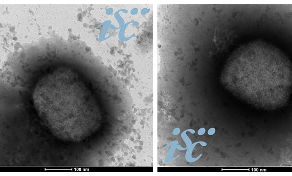 CIBERINFEC pone en marcha el proyecto multicéntrico MONKPOX-ESP22 en colaboración con el CIBERESP CIBERINFEC pone en marcha el proyecto multicéntrico MONKPOX-ESP22 en colaboración con el CIBERESP