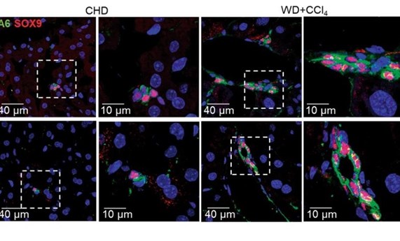 Estudian en células ovales cómo la inhibición del gen Pptn1 protege contra la lipotoxicidad favoreciendo la formación de gotas lipídicas Estudian en células ovales cómo la inhibición del gen Pptn1 protege contra la lipotoxicidad favoreciendo la formación de gotas lipídicas