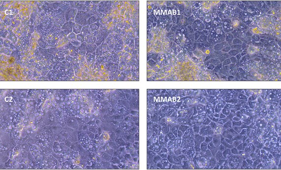 Diseñan una plataforma que evalúa farmacochaperonas en modelos celulares de acidemia metilmalónica tipo ‘cblB’ Diseñan una plataforma que evalúa farmacochaperonas en modelos celulares de acidemia metilmalónica tipo ‘cblB’