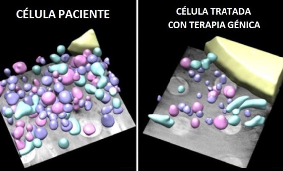 Probada la terapia génica contra la distrofia muscular en células de pacientes Probada la terapia génica contra la distrofia muscular en células de pacientes