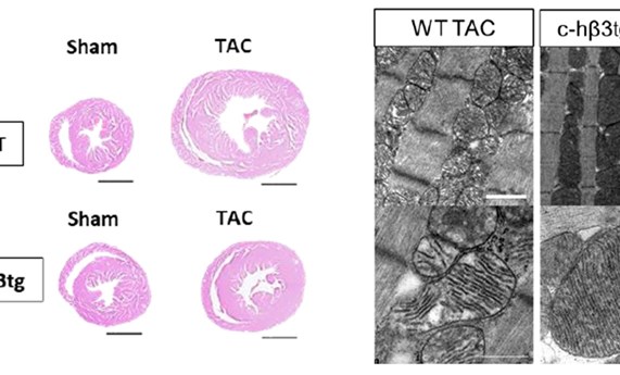 Identifican una nueva diana terapéutica capaz de prevenir la insuficiencia cardiaca asociada a estenosis aórtica Identifican una nueva diana terapéutica capaz de prevenir la insuficiencia cardiaca asociada a estenosis aórtica