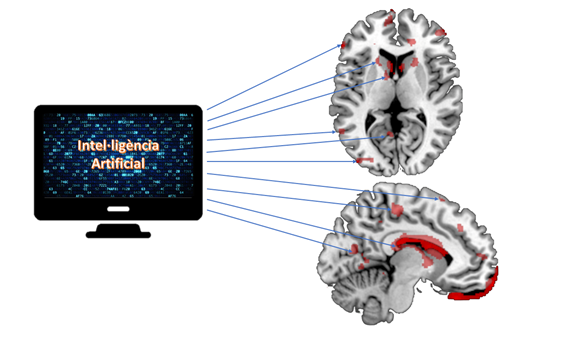 La resonancia magnética podría predecir el riesgo de recaída después de un primer brote psicótico La resonancia magnética podría predecir el riesgo de recaída después de un primer brote psicótico