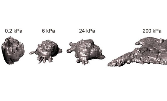 Las células cancerosas migran hacia a entornos rígidos como si fueran gotas Las células cancerosas migran hacia a entornos rígidos como si fueran gotas