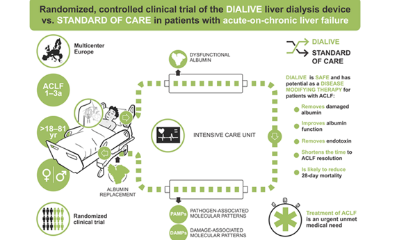 Primera valoración en humanos de un innovador dispositivo de diálisis para la insuficiencia hepática aguda sobre crónica Primera valoración en humanos de un innovador dispositivo de diálisis para la insuficiencia hepática aguda sobre crónica