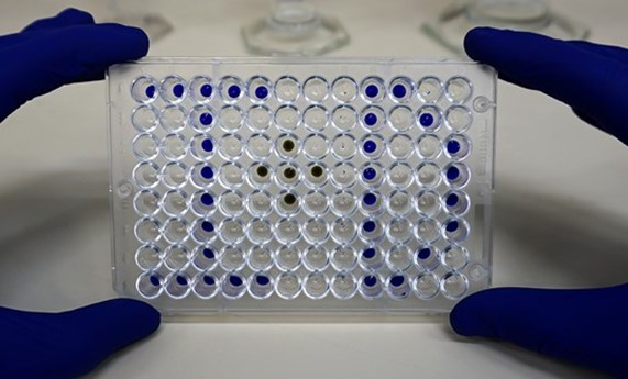 CIBERER lanza la convocatoria anual de Acciones Cooperativas y Complementarias Intramurales (ACCI) 2024 CIBERER lanza la convocatoria anual de Acciones Cooperativas y Complementarias Intramurales (ACCI) 2024