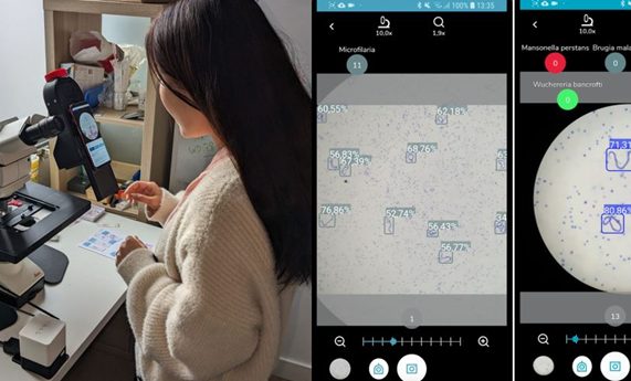 Inteligencia artificial en un teléfono móvil para diagnosticar enfermedades tropicales desatendidas Inteligencia artificial en un teléfono móvil para diagnosticar enfermedades tropicales desatendidas