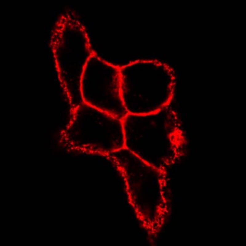 Un nuevo estudio revela que la enzima PADI3 contribuye a la resistencia al tratamiento con neratinib en el cáncer de mama HER2 positivo