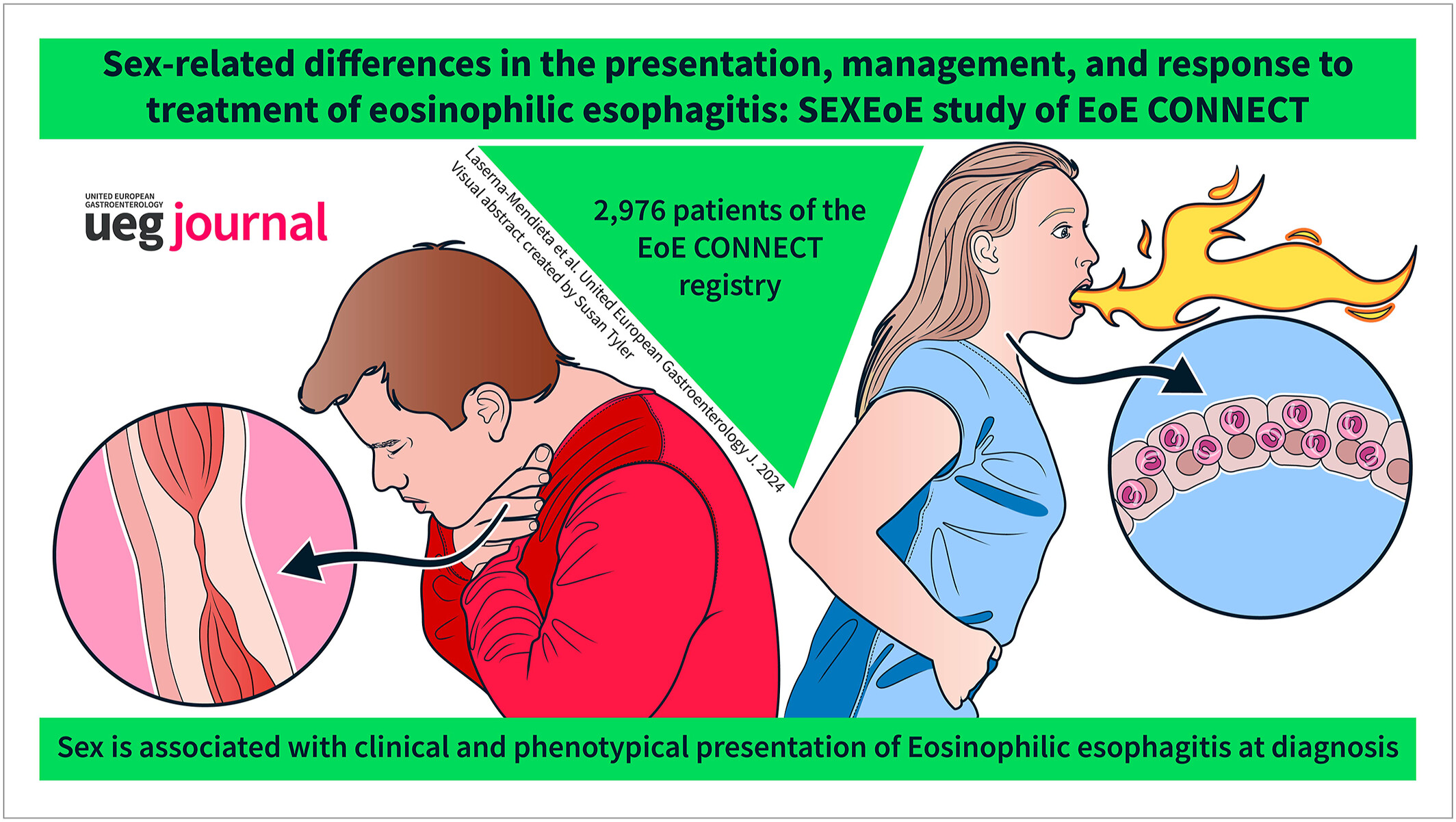El estudio SexEoE del registro EoE CONNECT establece diferencias de sexo en la esofagitis eosinofílica
