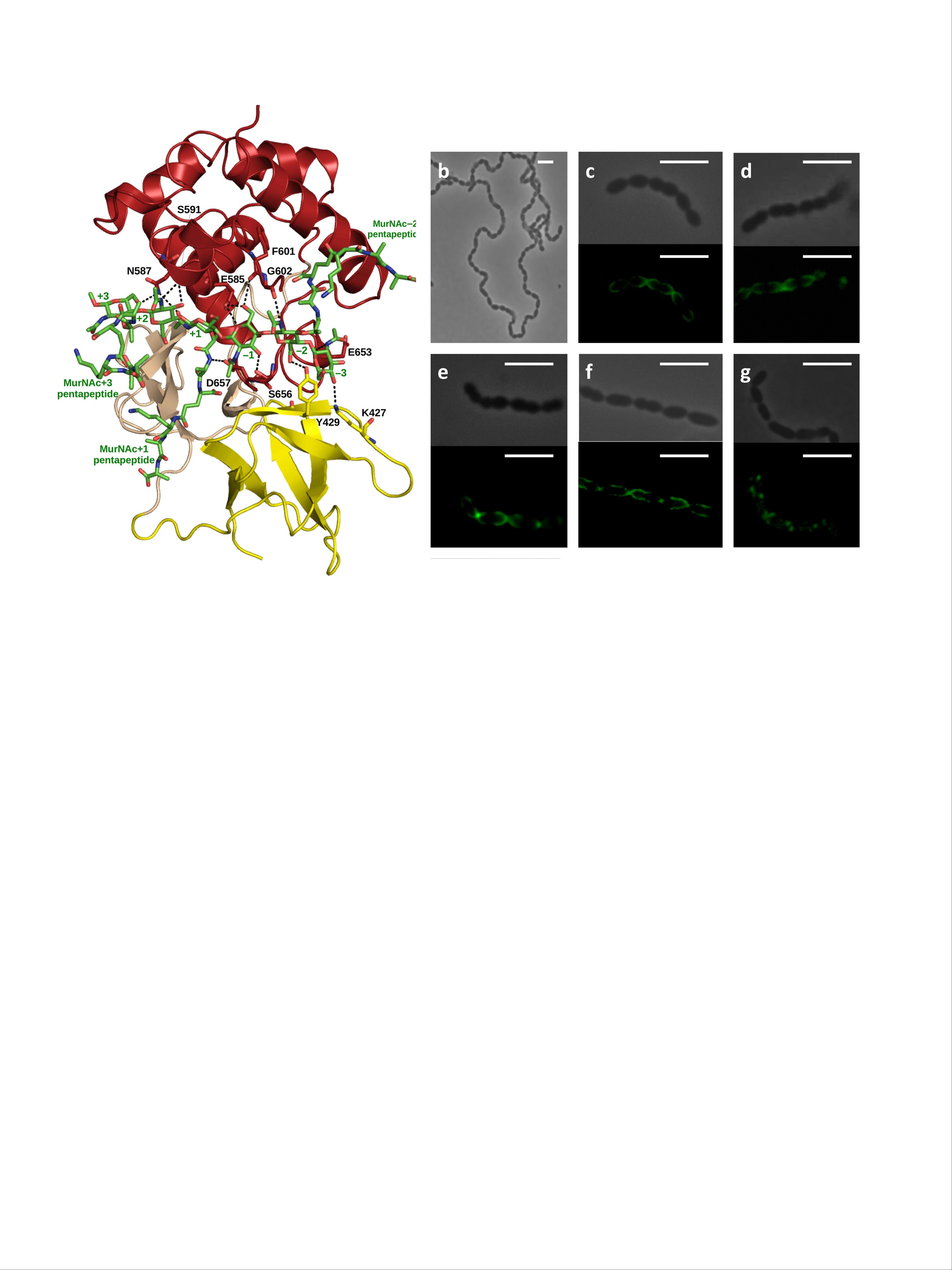 Caracterizan en profundidad la proteína LytB de neumococo