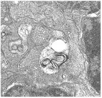 La autofagia resuelve la inflamación retiniana causada por el déficit en IGF-1 en el ratón