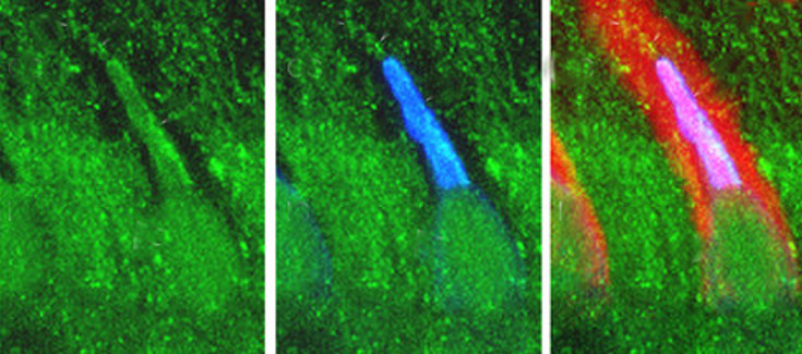 Descubren una nueva variante genética causante de retinitis pigmentosa
