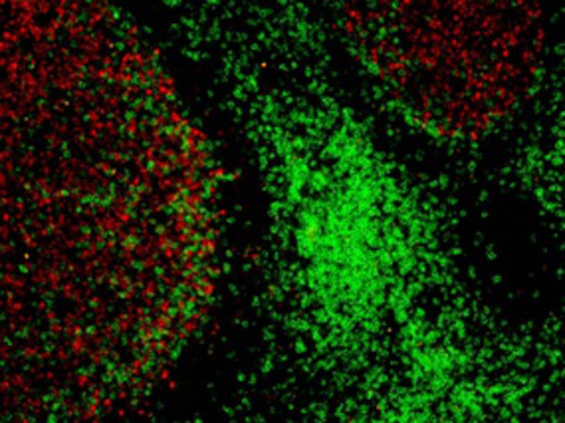 Un nueva técnica mejora el diagnóstico clínico con sondas fluorescentes